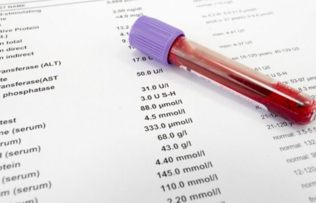 تحاليل الفيتامينات والمعادن: 9 فيتامينات ومعادن وما هي دلالات التحاليل؟