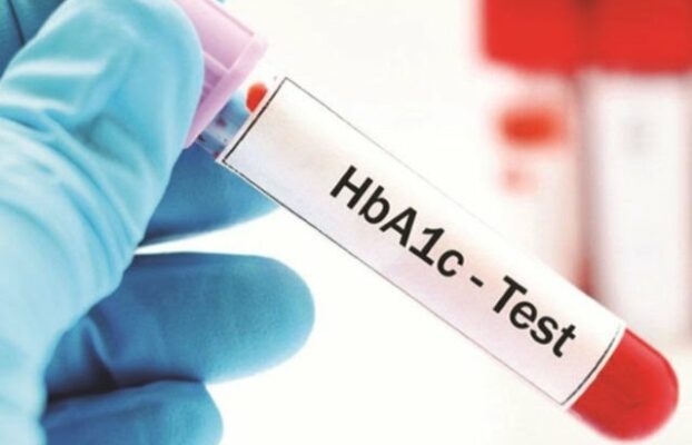 اختبار السكر التراكمي