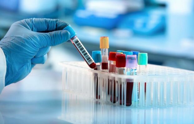 قراءة التحاليل الطبية لفقر الدم: 5 خطوات مهمة لتقرأ أي تحليل