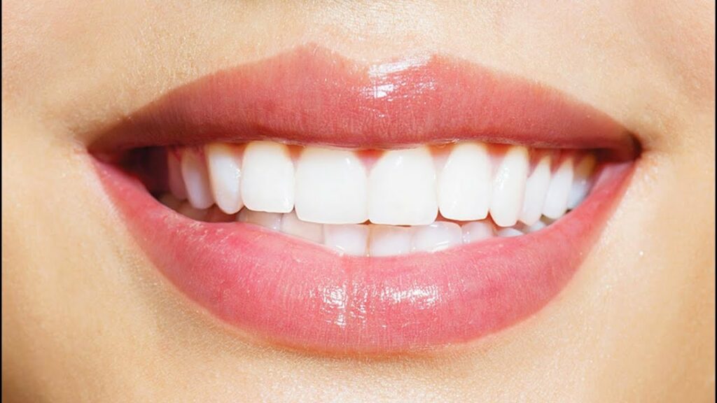 Teeth Whitening and Cleaning