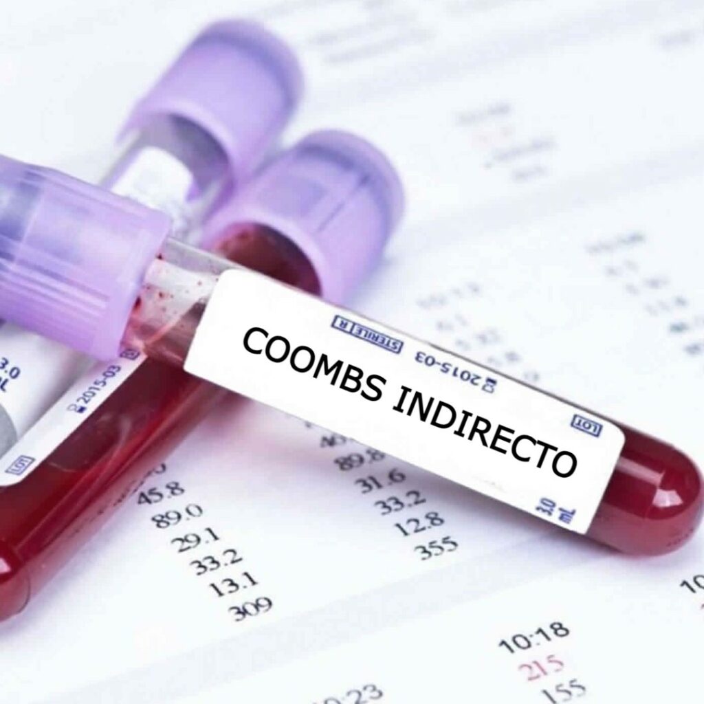 اختبار كومبس غير المباشر