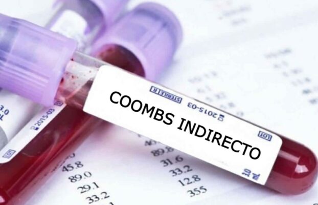 اختبار كومبس غير المباشر