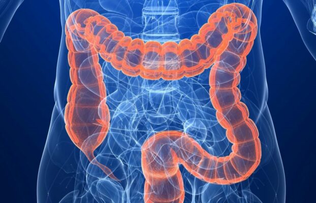 القولون العصبي