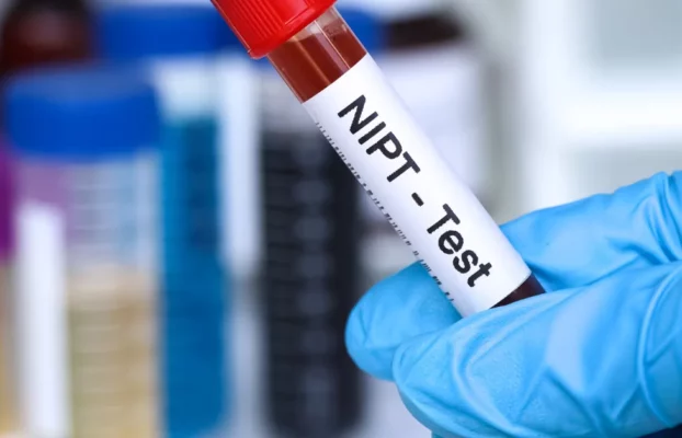 تحليل NIPT