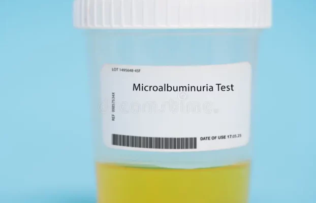 الميكرو ألبومين في البول