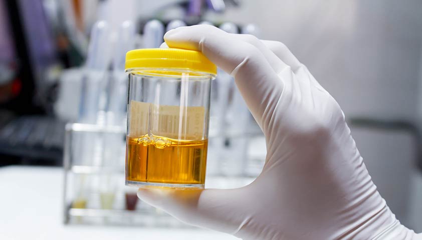 التهاب الإحليل عند الرجال