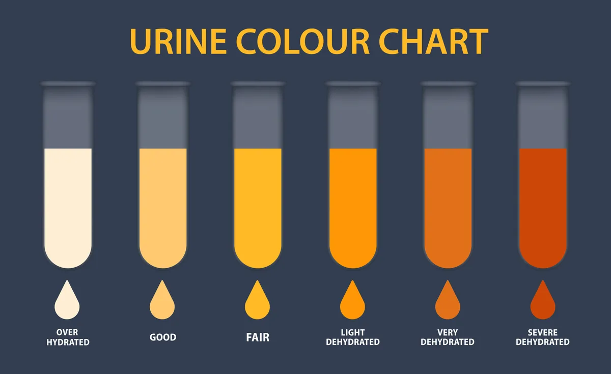 دلالات لون البول: على ماذا يدل لون البول اصفر غامق؟