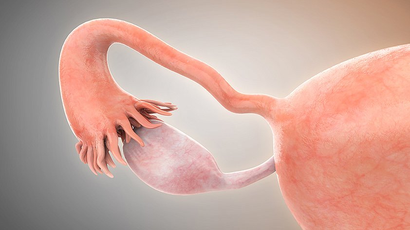 انسداد قناة فالوب والحمل: هل يمكن الحمل رغم انسداد قناة فالوب؟