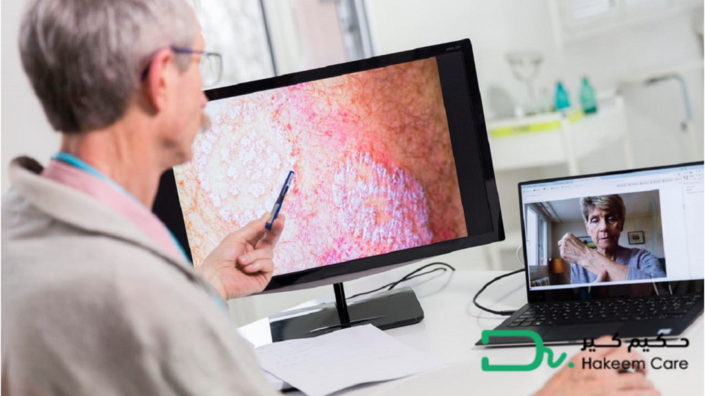 استشارة طبيب جلدية أونلاين