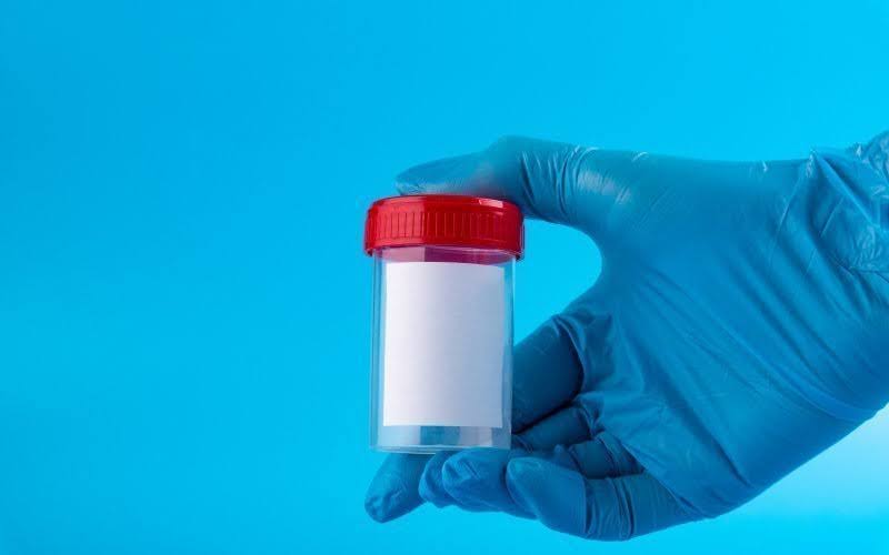 تحليل السائل المنوي للرجل: خطوة أساسية لفهم الخصوبة الذكرية