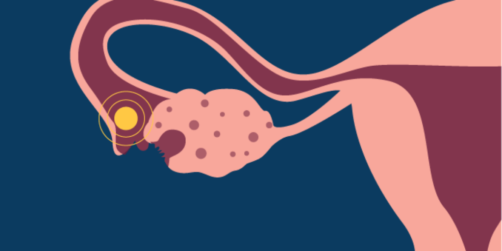 اسباب عدم الاباضة