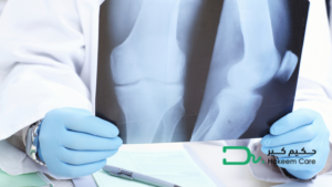 استشارة طبيب عظام