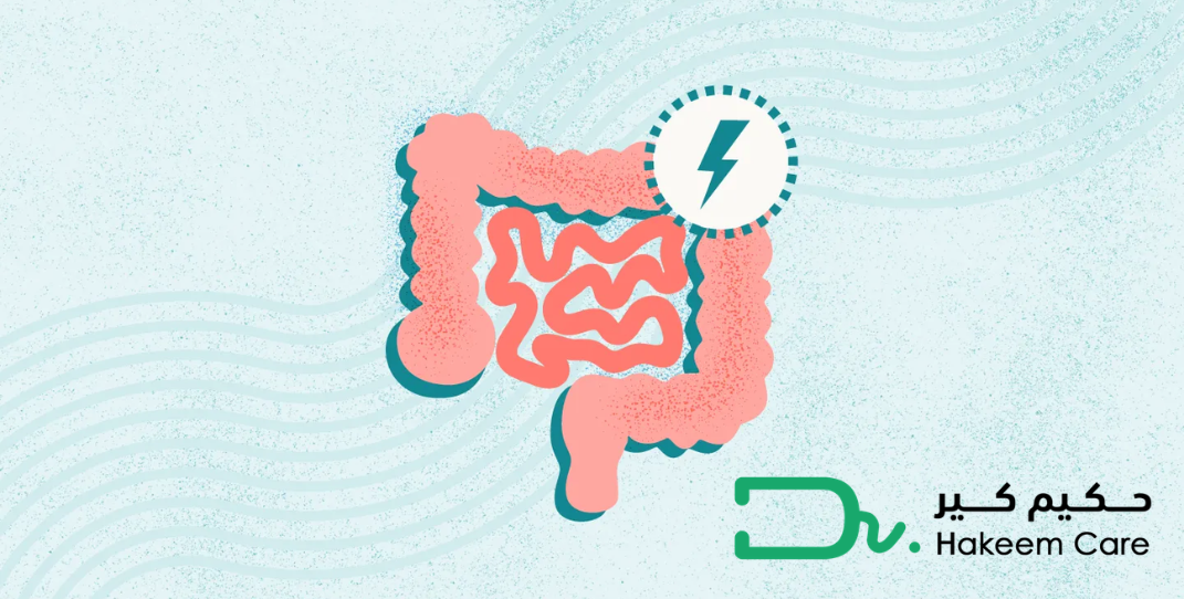 علاج القولون العصبي