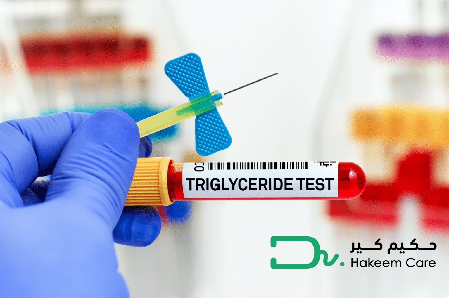 تحليل الكولسترول والدهون الثلاثية