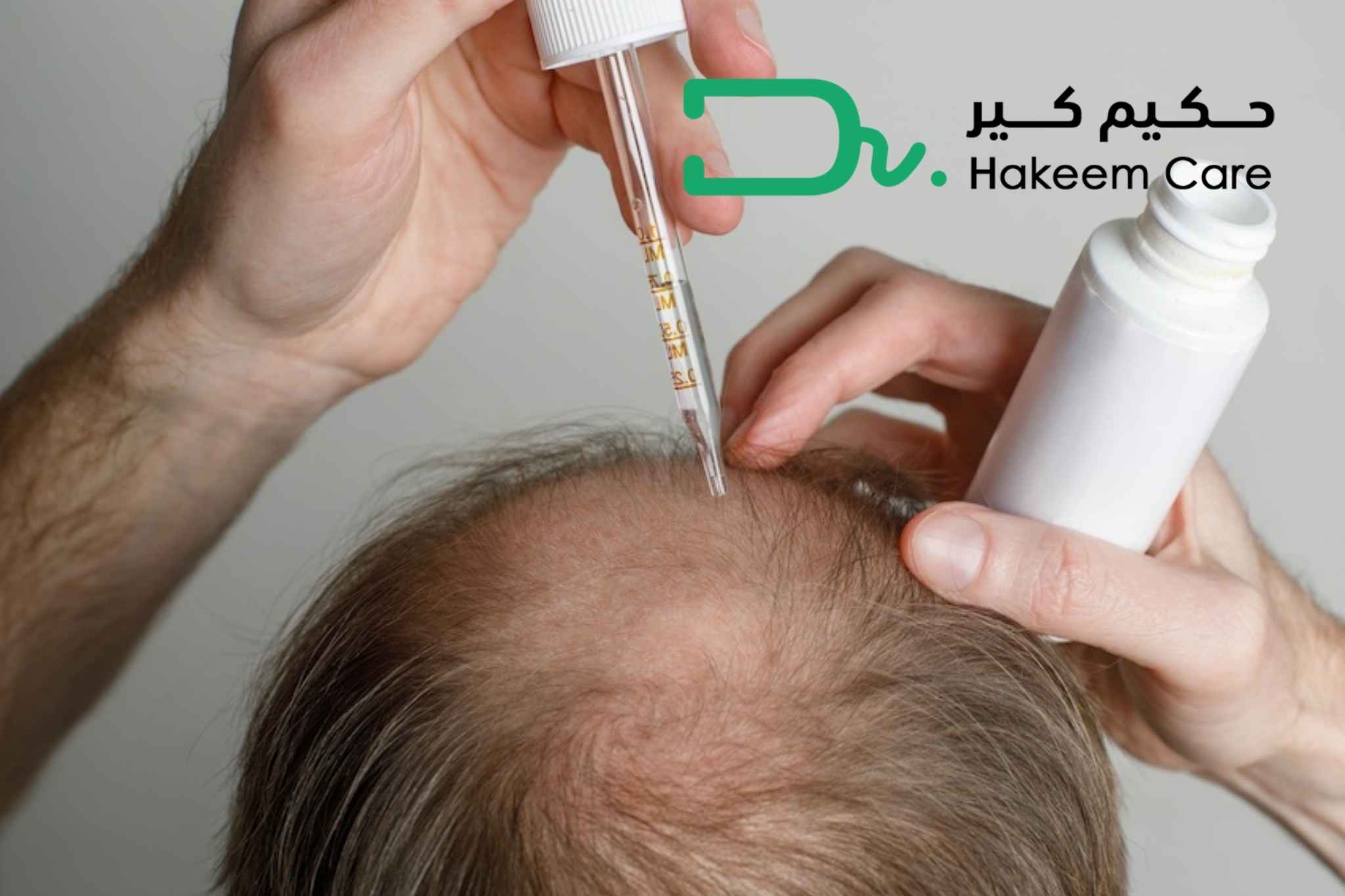 طريقة استخدام المينوكسيديل
