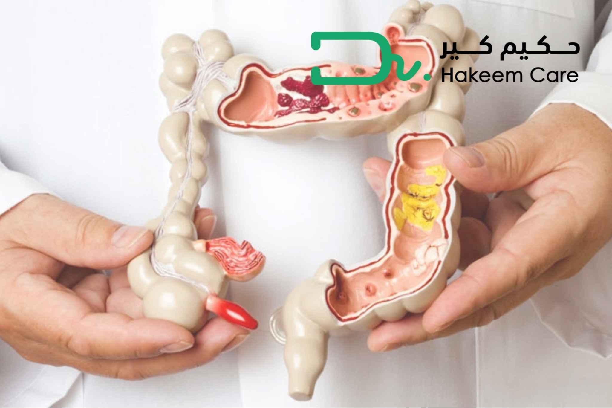 ما هو دوسباتالين للقولون