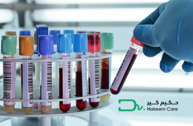 How to Prepare for Blood Tests