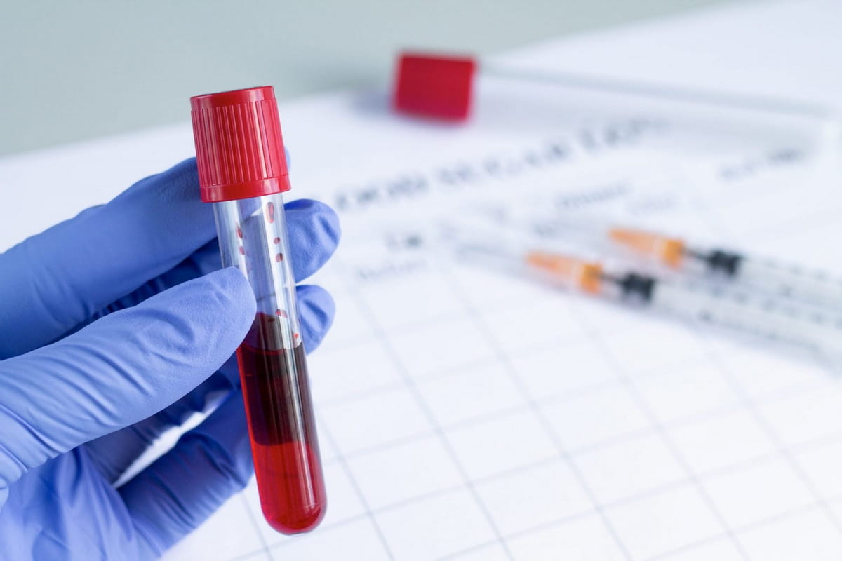 How to Prepare for Blood Tests