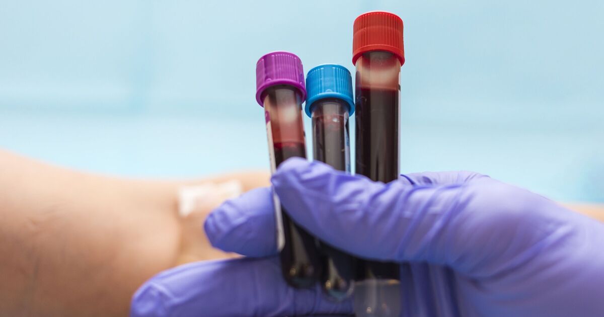 How to Prepare for Blood Tests