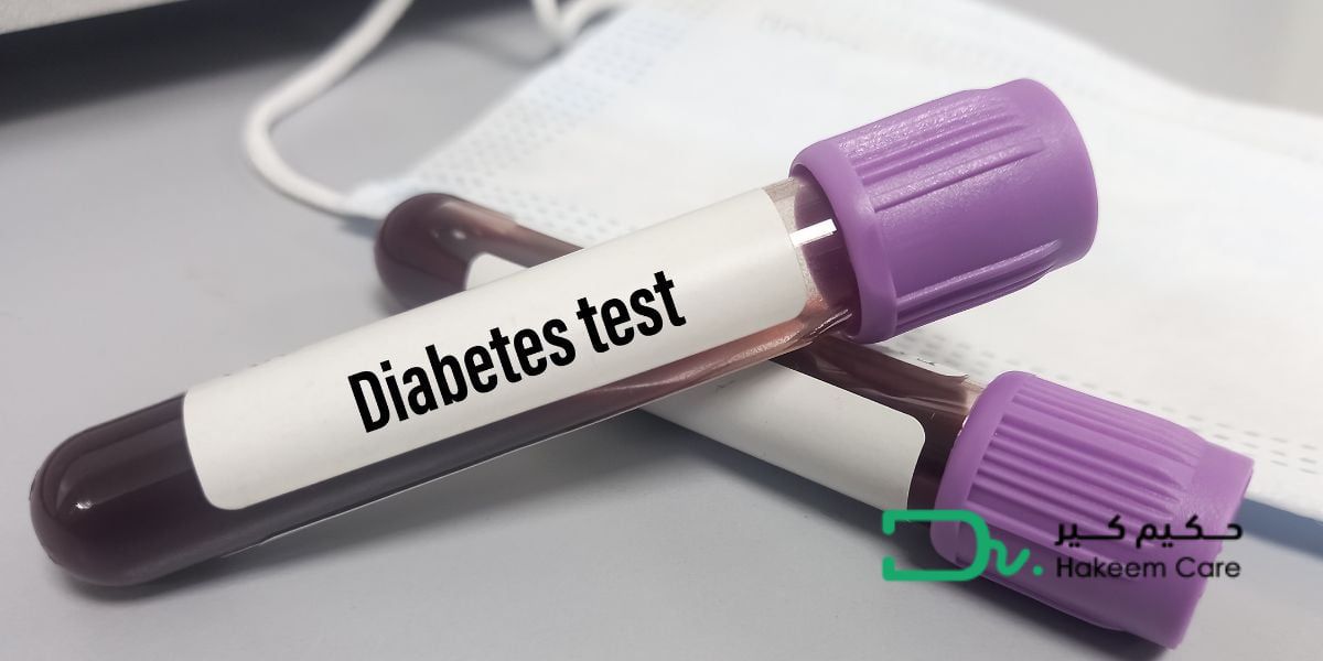 Best Tests for Diabetes Diagnosis: Complete Guide