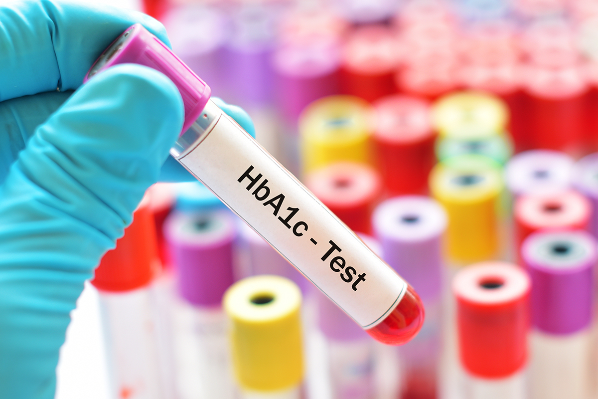 Best Tests for Diabetes Diagnosis