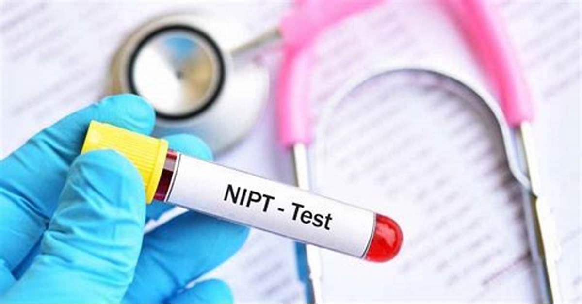 أحدث فحوصات ما قبل الولادة NIPT